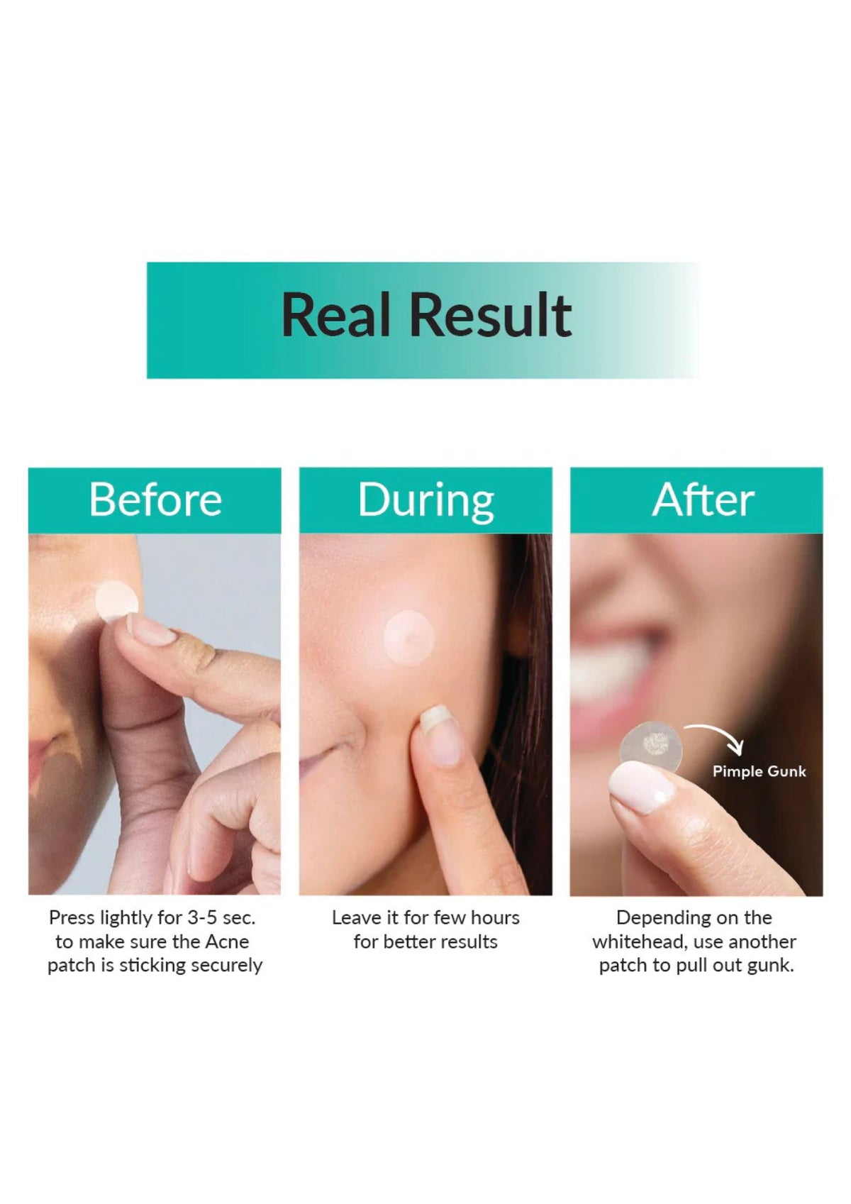 Some By Mi 30 Days Miracle Clear Spot Patch